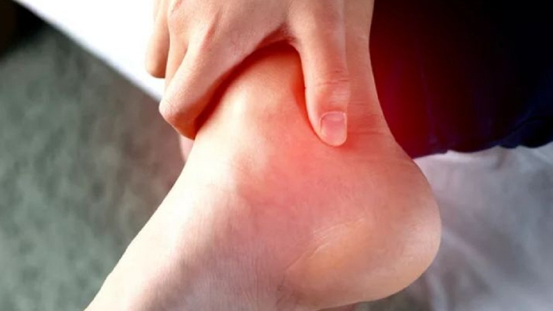 Bệnh gout thường đau ở đâu? Cách giảm đau hiệu quả 1