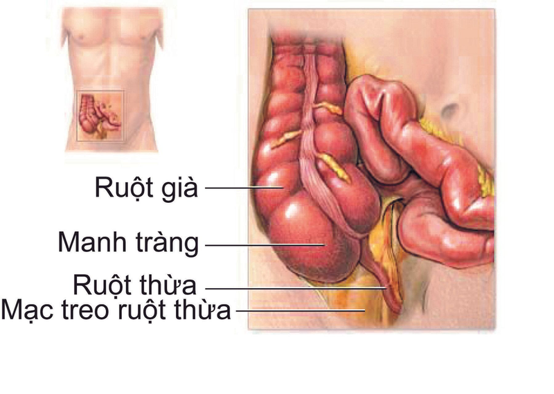 Bệnh lao hồi manh tràng là gì? Điều trị lao hồi manh tràng như thế nào? 1