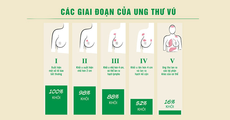 Bệnh nhân ung thư vú sống được bao lâu? 2