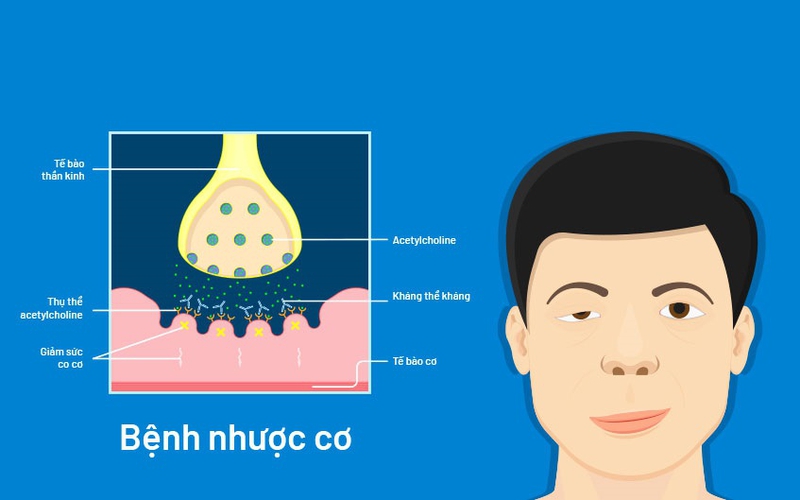 Biến chứng và cách quản lý