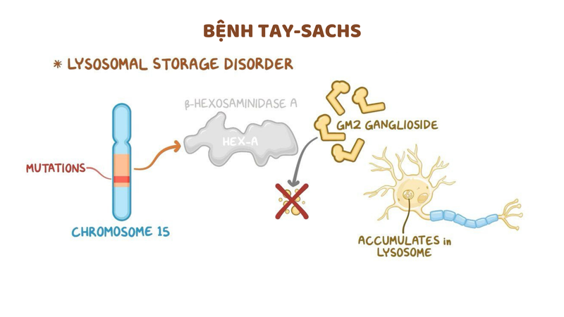 Bệnh Tay-Sachs: Nguyên nhân, triệu chứng và hướng điều trị 2