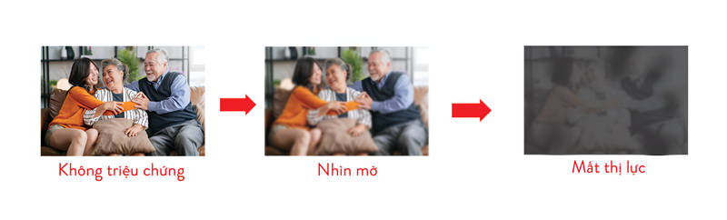 Việc điều trị tập trung vào hai hướng: Kiểm soát bệnh nền và can thiệp chuyên khoa mắt