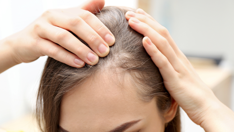 Bị nấm da đầu có gây rụng tóc không? 3