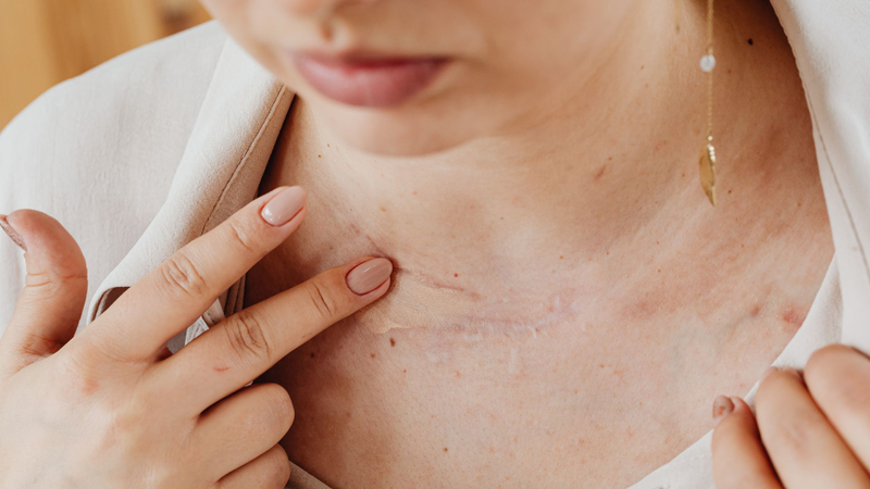 Bị sẹo lõm có nên ăn rau muống không? Những điều cần biết 1