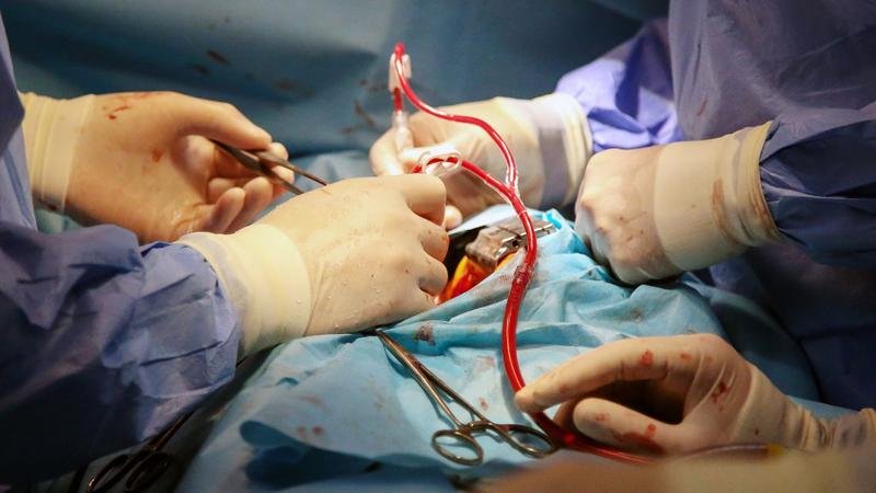 10 Biến chứng sau thay van tim thường gặp nhất: Nhận biết và phòng ngừa 1