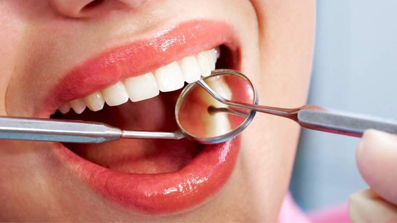 Biến chứng viêm lợi trùm do răng khôn 2