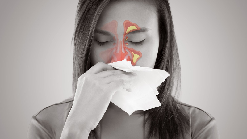 Bộ rửa mũi Otosan Nasal Wash - Làm sạch mũi an toàn cho người viêm xoang 1