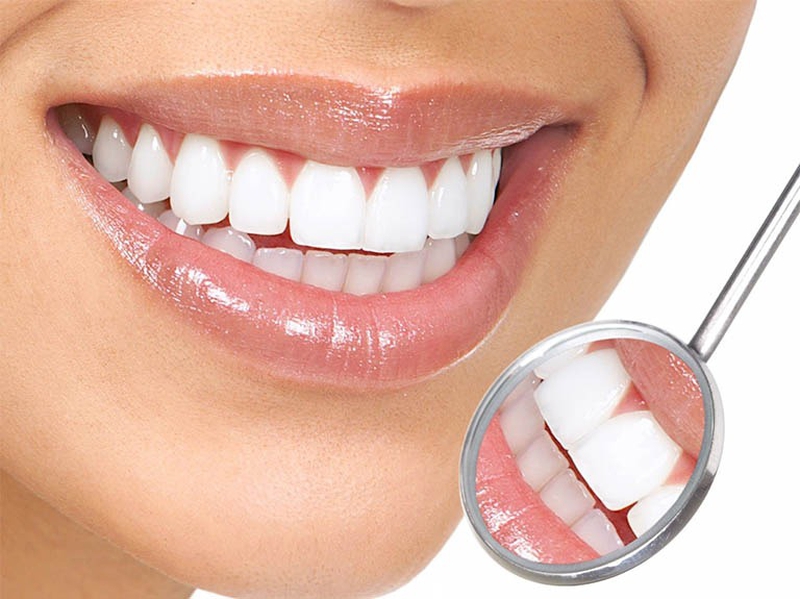 Giải đáp: Bọc răng sứ có bền không? Quy trình bọc răng sứ? 2