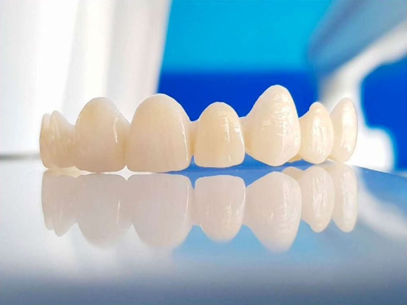 Bọc răng sứ có hại không? Những điều cần lưu ý khi bọc răng sứ 3