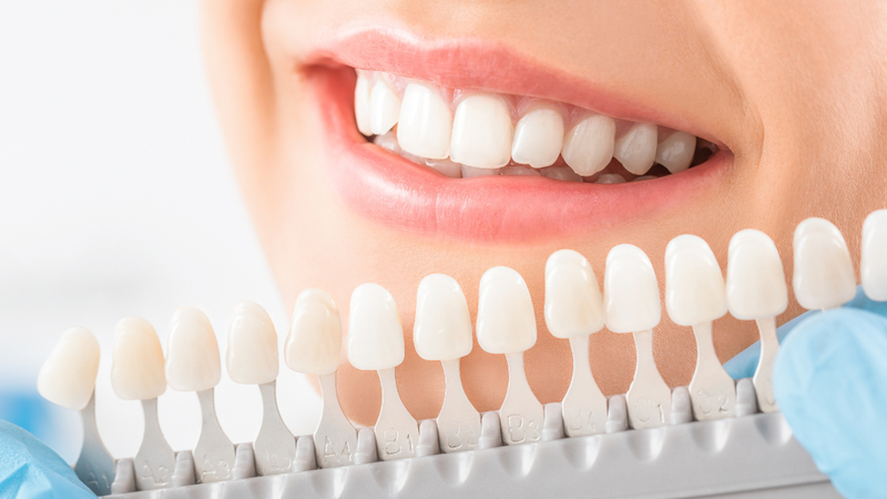 Chi phí bọc răng sứ phụ thuộc vào chất liệu, mỗi loại có ưu điểm và mức giá khác nhau