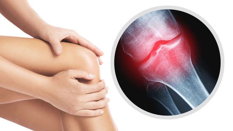 Cá bông lau: Giá trị dinh dưỡng và lợi ích sức khỏe từ loài cá nước ngọt được ưa chuộng 3