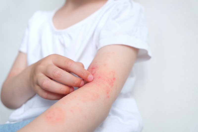 Các bệnh ký sinh trùng ở vật nuôi: Cơ chế lây nhiễm và cách phòng ngừa 2