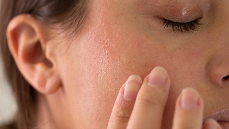 Các bệnh lý về da mặt và hướng dẫn phòng tránh hiệu quả 1