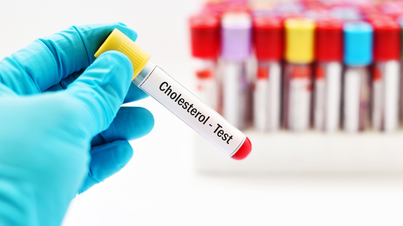 cac-chi-so-cholesterol-co-y-nghia-nhu-the-nao (3).png