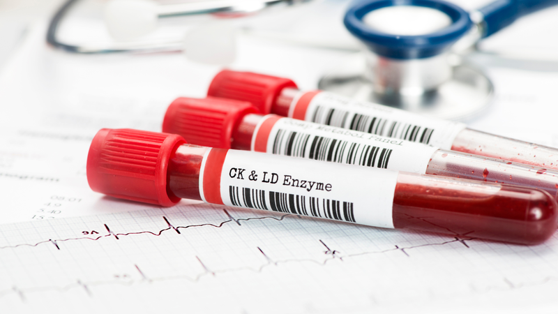 Một số chỉ số enzyme giúp định hướng chẩn đoán khi có nghi ngờ tổn thương cơ quan nào đó