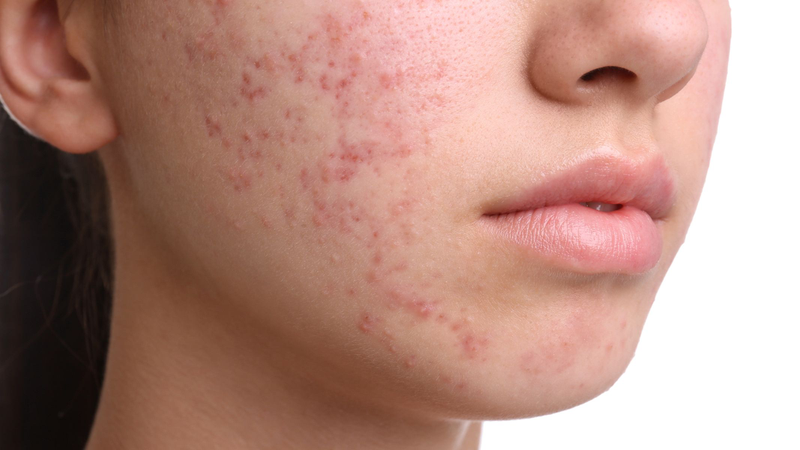 Các dấu hiệu dậy thì ở bé gái và những thay đổi của cơ thể 4