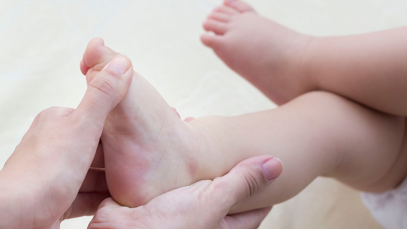 Các dị tật ở chân thường gặp ở trẻ sơ sinh 1