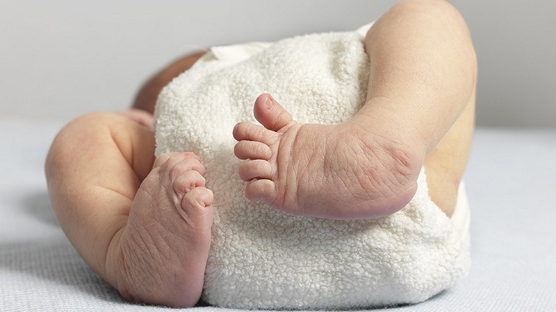 Các dị tật ở chân thường gặp ở trẻ sơ sinh 2