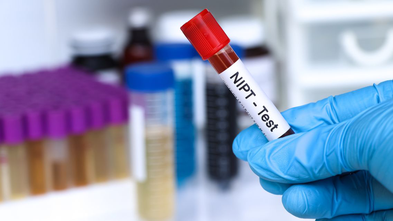 Tìm hiểu các gói xét nghiệm NIPT là việc mỗi mẹ bầu nên làm