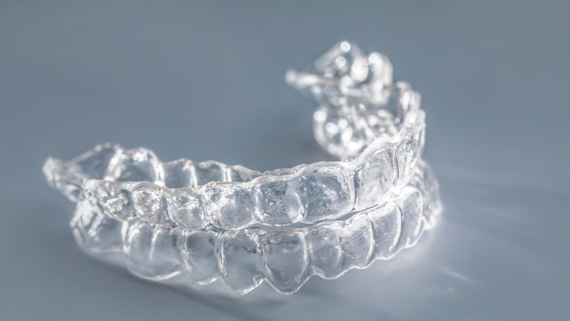 Các loại niềng răng trong suốt hiện nay: So sánh cụ thể từng loại! 1