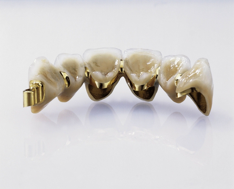 Các loại răng sứ thẩm mỹ phổ biến hiện nay 4