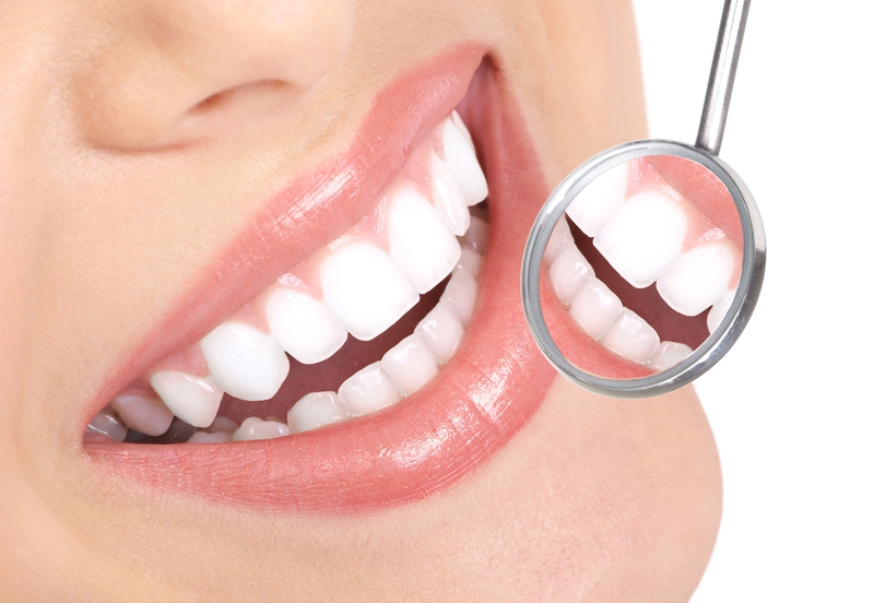 Các loại răng sứ thẩm mỹ phổ biến hiện nay 5