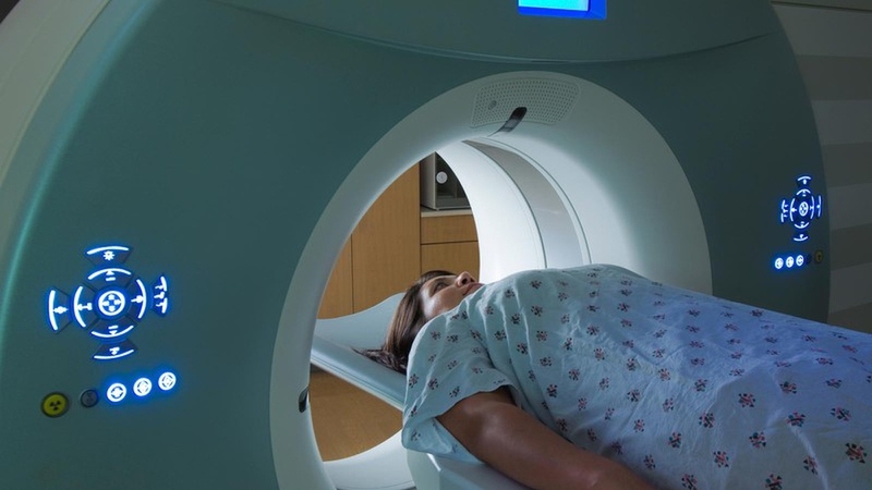 Các loại xuất huyết não: Phân loại cụ thể và cách chẩn đoán 2