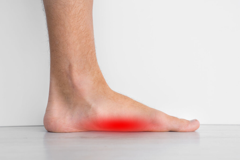 Cách chữa bàn chân bẹt ở người lớn và một số biến chứng có thể gặp 1