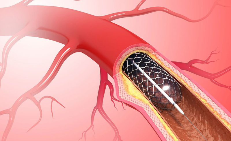 Cách điều trị sỏi đường mật trong gan​ hiệu quả 4
