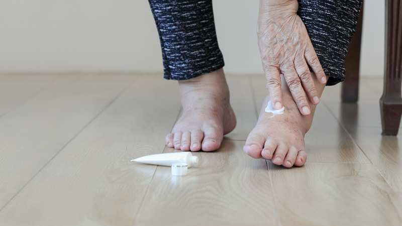 Cách điều trị vảy nến chân - Bệnh vảy nến là gì? 2