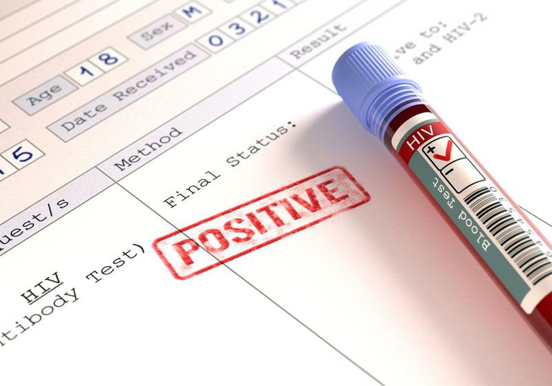 Cách đọc kết quả xét nghiệm HIV cực dễ dàng và chính xác! 4