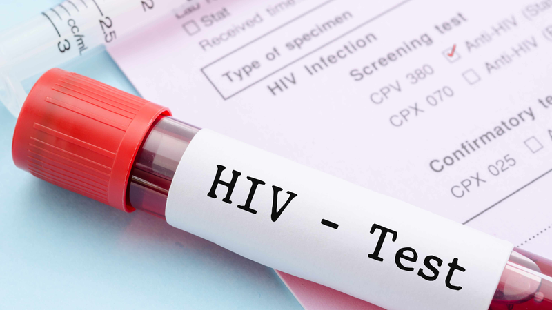 Cách đọc kết quả xét nghiệm HIV cực dễ dàng và chính xác! 1