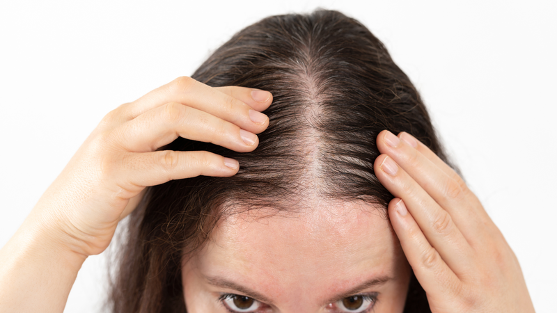 Cách khắc phục rụng tóc ở nữ giới: Nguyên nhân và giải pháp hiệu quả, an toàn 2