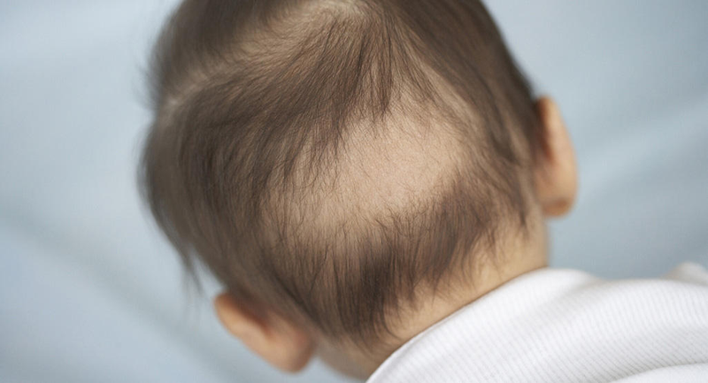 Cách khắc phục tình trạng rụng tóc ở trẻ sơ sinh 3 tháng tuổi 1