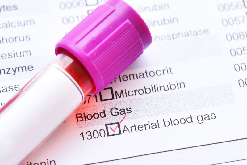 Cách lấy khí máu động mạch làm xét nghiệm như thế nào? Những lưu ý cần biết 1