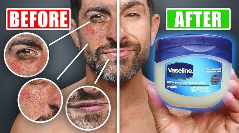 Hướng dẫn cách sử dụng Vaseline cho da mặt​ 4