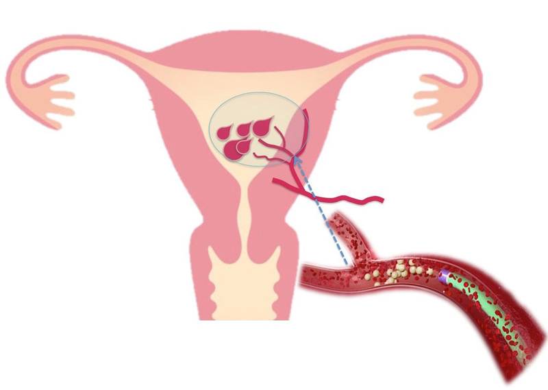 Cách tống sản dịch sau sinh mổ nhanh chóng cho thai phụ -1