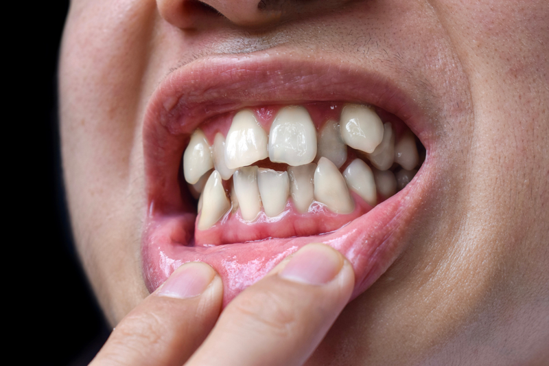 Cách trị đau răng đơn giản tại nhà cải thiện cơn đau hiệu quả 2