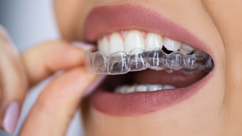 Cách trị nghiến răng khi ngủ - Nguyên nhân dẫn đến tật nghiến răng khi ngủ 4