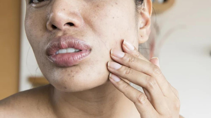 Cảm giác có con gì bò trên mặt có phải dấu hiệu của bệnh lý? 1