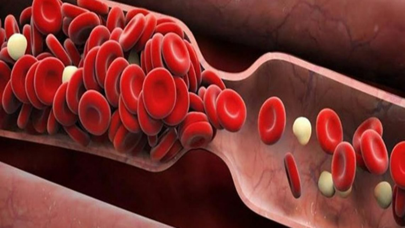 Cảnh báo tình trạng lưu thông máu kém: Nguyên nhân và cách khắc phục 1
