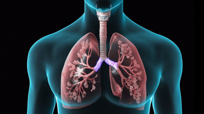 Cấu tạo, chức năng của hệ hô hấp và một số bệnh thường gặp3