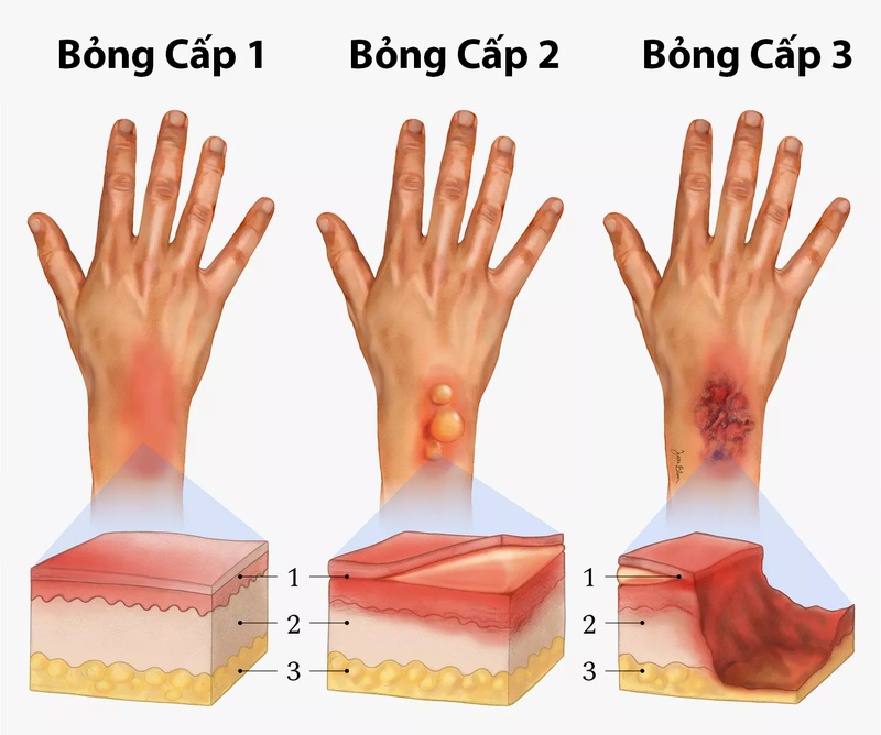 Cây sảng: Dược liệu dân gian dễ tìm và thân thiện với sức khỏe 2