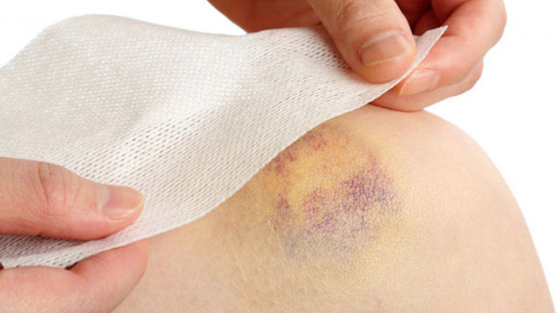 Cây sảng: Dược liệu dân gian dễ tìm và thân thiện với sức khỏe 3