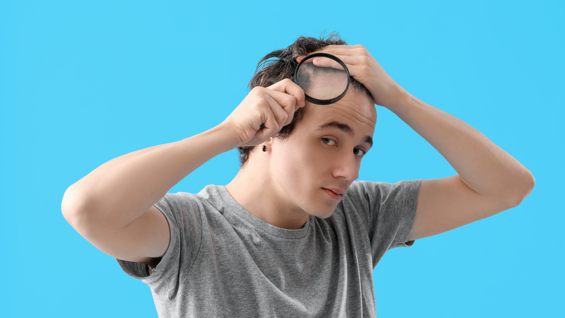 Cấy tóc bao nhiêu tiền? Những lưu ý về giá và những thắc mắc phổ biến 5