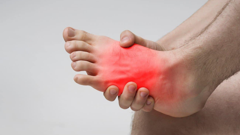 Chân bị sưng đau nhức ở vùng mu bàn chân là bệnh gì? Cách giảm đau nhanh 2