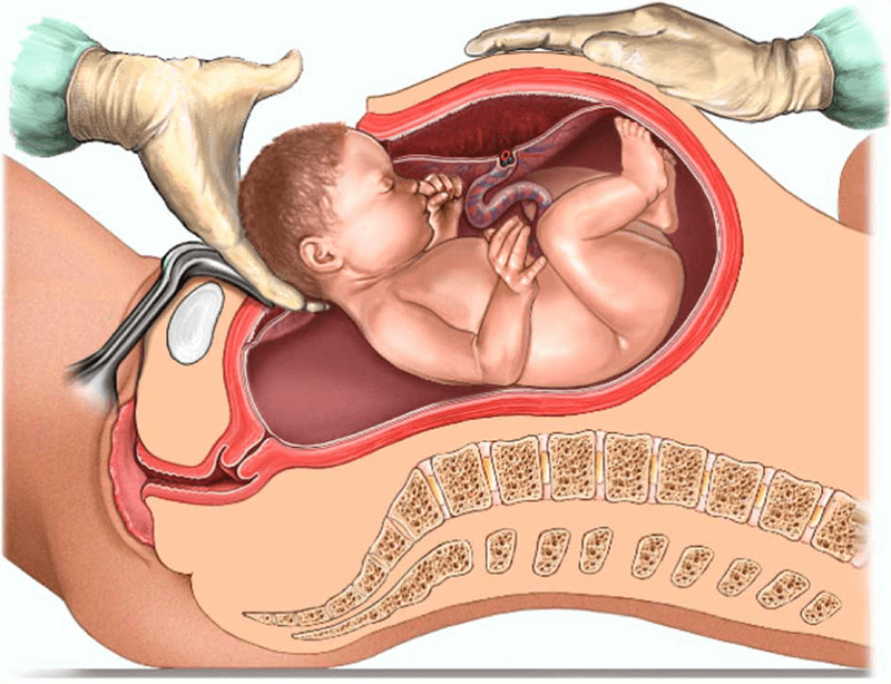 Chỉ định mổ lấy thai: 3 trường hợp bắt buộc can thiệp để giữ an toàn cho mẹ và bé 1