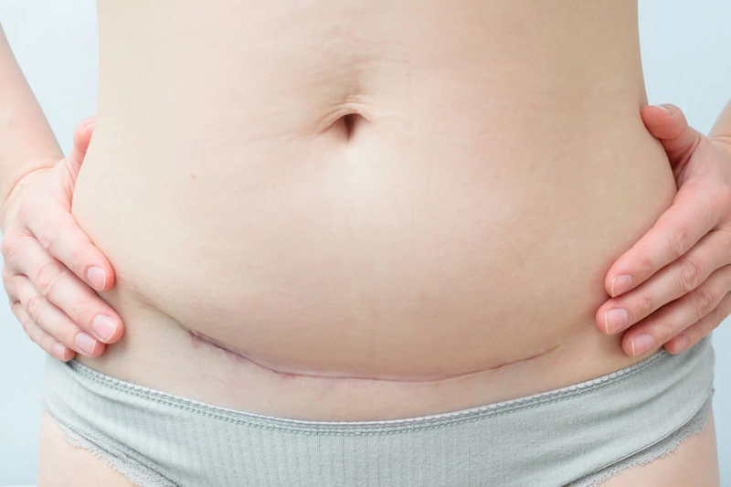 Chỉ định mổ lấy thai: 3 trường hợp bắt buộc can thiệp để giữ an toàn cho mẹ và bé 2