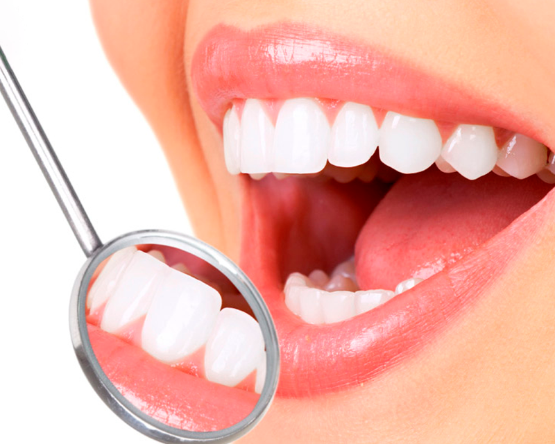 Chi phí bọc răng sứ cho răng hô như thế nào? 1