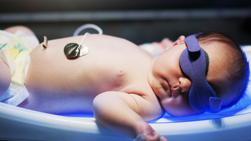 Nhân viên y tế sẽ che kín mắt trẻ bằng băng tối màu và che bộ phận sinh dục để tránh tổn thương do ánh sáng